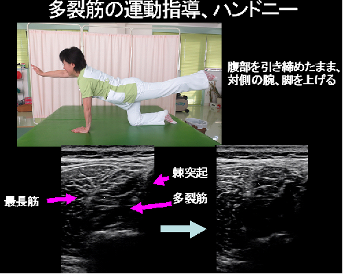 体幹安定化運動・腹横筋・多裂筋強化の指導