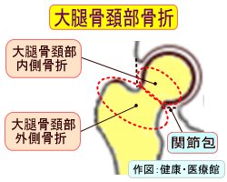 股関節H27.12