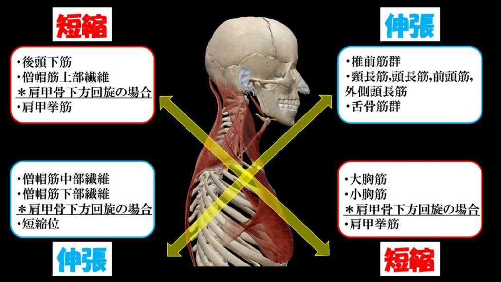 首の過伸展の症状は何ですか?